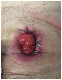 重口皮炎在线视频